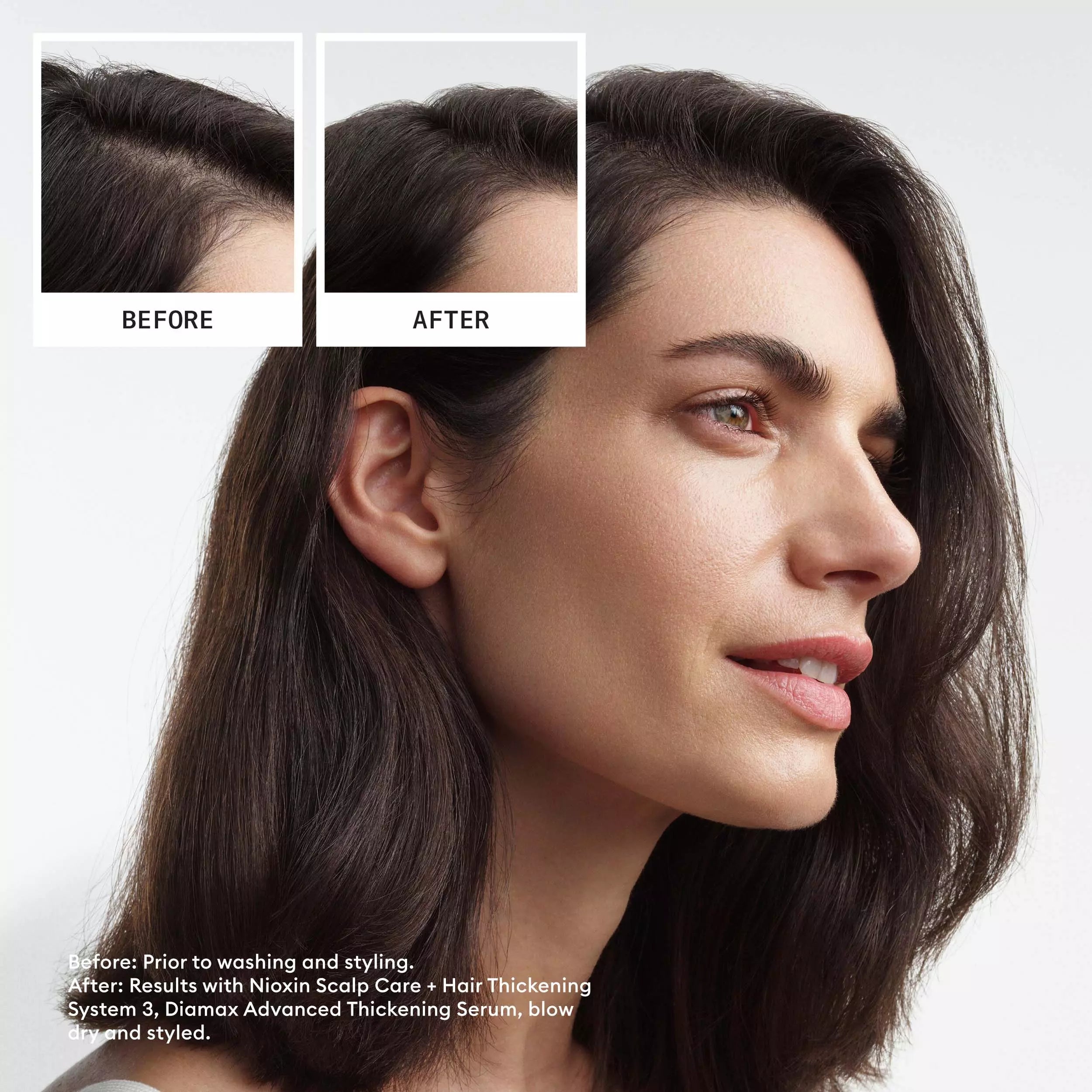 Nioxin System 3